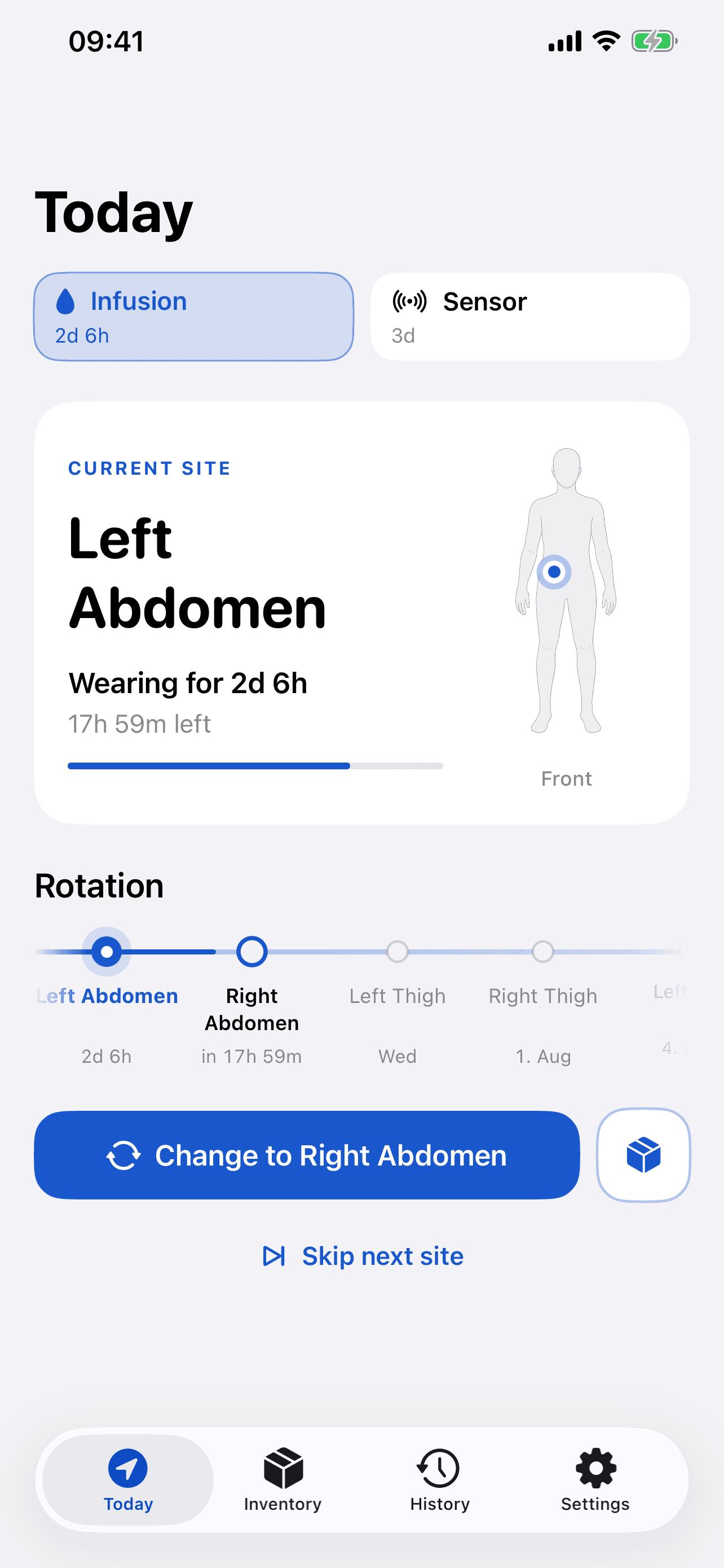 Next Site Today screen showing the current infusion site, wear time, progress, and upcoming rotation